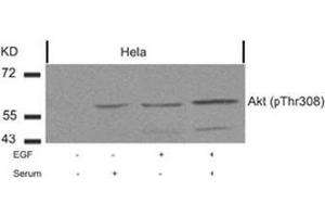 Image no. 2 for anti-V-Akt Murine Thymoma Viral Oncogene Homolog 1 (AKT1) (pThr308) antibody (ABIN196711) (AKT1 anticorps  (pThr308))