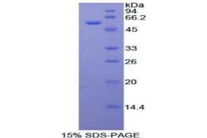 SDS-PAGE (SDS) image for Forkhead Box P3 (FOXP3) (AA 190-412) protein (His tag,GST tag) (ABIN2122877) (FOXP3 Protein (AA 190-412) (His tag,GST tag))