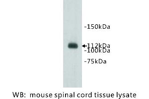 Image no. 1 for anti-Transmembrane Protein 67 (TMEM67) antibody (ABIN1112910) (TMEM67 anticorps)