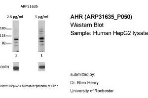 Western Blotting (WB) image for anti-Aryl Hydrocarbon Receptor (AHR) (N-Term) antibody (ABIN182389) (Aryl Hydrocarbon Receptor anticorps  (N-Term))
