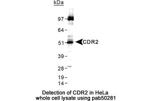 Image no. 2 for anti-Cerebellar Degeneration-Related Protein 2, 62kDa (CDR2) (C-Term) antibody (ABIN363590) (CDR2 anticorps  (C-Term))