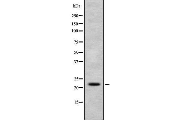 H1FX anticorps  (N-Term)