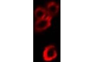 Immunofluorescent analysis of Alpha-enolase staining in Hela cells. (ENO1 anticorps)