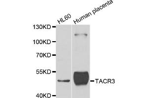 Western blot analysis of extracts of various cell lines, using TACR3 antibody (ABIN5975101) at 1/1000 dilution. (TACR3 anticorps)