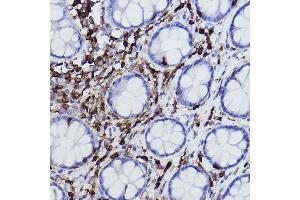 Immunohistochemistry of paraffin-embedded human colon using L-Plastin/LCP1 Rabbit mAb (ABIN7268317) at dilution of 1:100 (40x lens). (LCP1 anticorps)