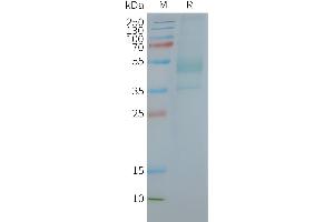 Human C-Nanodisc, Flag Tag on SDS-PAGE (CXCR2 Protéine)