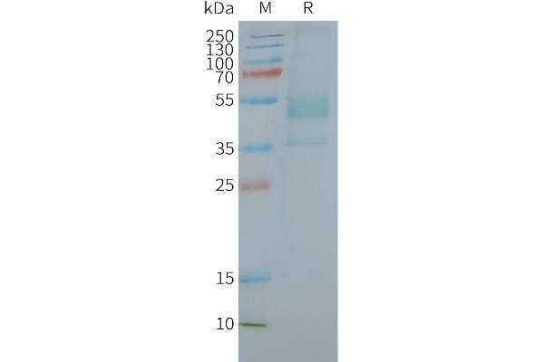 CXCR2 Protéine