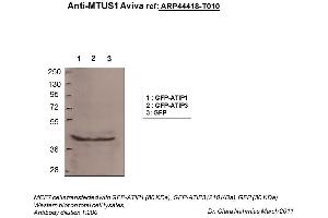 Image no. 2 for anti-Microtubule Associated Tumor Suppressor 1 (MTUS1) (N-Term) antibody (ABIN310597) (MTUS1 anticorps  (N-Term))