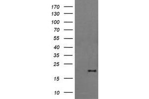 Image no. 2 for anti-Fetal and Adult Testis Expressed 1 (FATE1) antibody (ABIN1498226) (FATE1 anticorps)