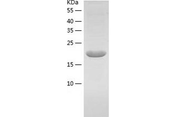 FGF10 Protein (AA 37-215) (His tag)