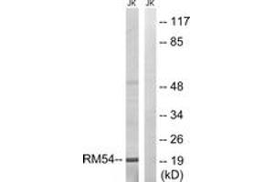 Western blot analysis of extracts from Jurkat cells, using MRPL54 Antibody. (MRPL54 anticorps  (AA 81-130))