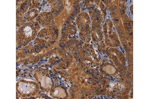 Immunohistochemistry (IHC) image for anti-Melanoma Antigen Family B, 10 (MAGEB10) antibody (ABIN2423757) (MAGEB10 anticorps)