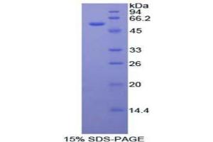 SDS-PAGE analysis of Mouse FOXP3 Protein. (FOXP3 Protéine)