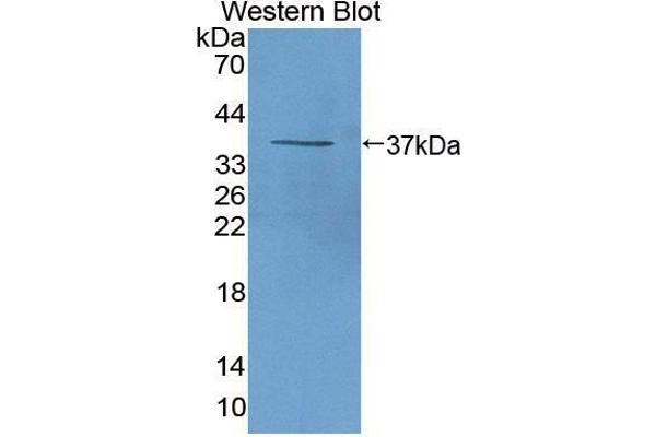 beta-Thromboglobulin anticorps  (AA 46-107)