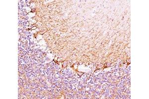 IHC testing of cerebellum stained with Neurofilament Heavy antibody (RT97). (NEFH anticorps)