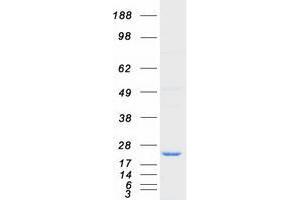 Validation with Western Blot (UBE2G2 Protein (Transcript Variant 1) (Myc-DYKDDDDK Tag))