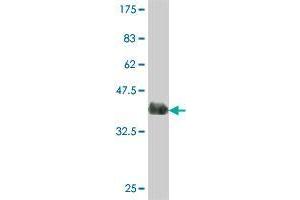 Western Blot detection against Immunogen (37. (MLKL anticorps  (AA 371-471))