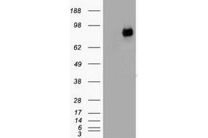 HEK293T cells were transfected with the pCMV6-ENTRY control (Left lane) or pCMV6-ENTRY CTNNB1 (Right lane) cDNA for 48 hrs and lysed. (CTNNB1 anticorps  (AA 531-781))