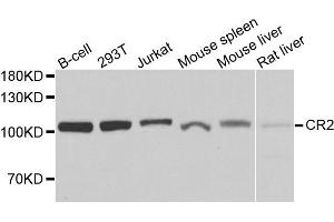 Western blot analysis of extracts of various cells, using CR2 antibody. (CD21 anticorps)