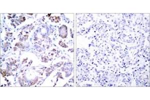 Immunohistochemistry (IHC) image for anti-Nuclear Factor-kB p65 (NFkBP65) (AA 221-270) antibody (ABIN2889039) (NF-kB p65 anticorps  (AA 221-270))