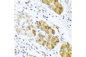 Immunohistochemistry of paraffin-embedded human stomach using CCL8 antibody (ABIN5975074) at dilution of 1/100 (40x lens). (CCL8 anticorps)