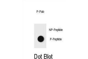 Dot blot analysis of Phospho-PTEN- Antibody Phospho-specific Pab (ABIN6241052 and ABIN6578937) on nitrocellulose membrane. (PTEN anticorps  (pThr382))