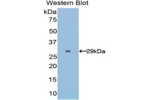 Western blot analysis of the recombinant protein. (UGCGL2 anticorps  (AA 1221-1408))