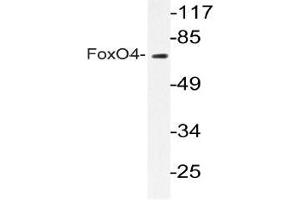 Western blot (WB) analyzes of FoxO4 antibody in extracts from COLO205 cells. (FOXO4 anticorps)