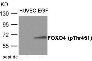 Western blot analysis of extracts from HUVEC cells treated with EGF using FOXO4 (Phospho-Thr451) Antibody. (FOXO4 anticorps  (pThr451))