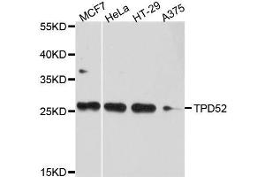 Western blot analysis of extracts of various cell lines, using TPD52 antibody. (TPD52 anticorps  (AA 1-184))