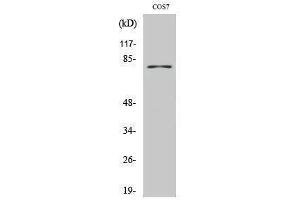 Western Blotting (WB) image for anti-Tyrosinase (TYR) (C-Term) antibody (ABIN3177845) (TYR anticorps  (C-Term))