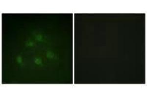 Immunofluorescence analysis of HeLa cells, using Smad1 (Ab-187) antibody. (SMAD1 anticorps  (Ser187))