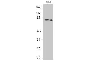 Western Blotting (WB) image for anti-Protein Kinase C, zeta (PRKCZ) (Thr410) antibody (ABIN5957395) (PKC zeta anticorps  (Thr410))