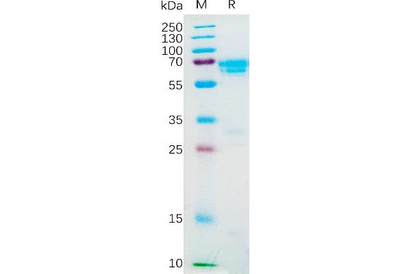 M-CSF/CSF1 Protein (AA 33-255) (Fc Tag)