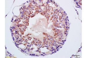 Formalin-fixed and paraffin embedded rat testis labeled with Rabbit Anti CITED1/ABCC1 Polyclonal Antibody, Unconjugated (ABIN1386284) at 1:200 followed by conjugation to the secondary antibody and DAB staining (Cited1/Abcc1 (AA 101-193) anticorps)