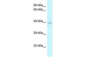 Image no. 1 for anti-Cysteine-Rich with EGF-Like Domains 2 (CRELD2) (C-Term) antibody (ABIN6747709) (CRELD2 anticorps  (C-Term))