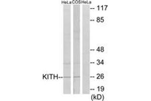 Western blot analysis of extracts from HeLa/COS7 cells, using KITH Antibody. (TK1 anticorps  (AA 161-210))