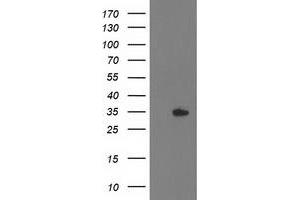 Western Blotting (WB) image for anti-Haloacid Dehalogenase-Like Hydrolase Domain Containing 2 (HDHD2) antibody (ABIN1498631) (HDHD2 anticorps)