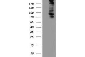 HEK293T cells were transfected with the pCMV6-ENTRY control (Left lane) or pCMV6-ENTRY ALDH1L1 (Right lane) cDNA for 48 hrs and lysed. (ALDH1L1 anticorps)