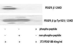Western Blotting (WB) image for anti-Platelet Derived Growth Factor Receptor beta (PDGFRB) (pTyr1021) antibody (ABIN3173423) (PDGFRB anticorps  (pTyr1021))