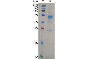 Human Protein, His Tag on SDS-PAGE under reducing condition. (MMP 9 Protein (AA 107-707) (His tag))