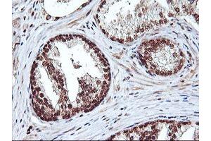 Image no. 2 for anti-Nonhomologous End-Joining Factor 1 (NHEJ1) antibody (ABIN1499733) (NHEJ1 anticorps)