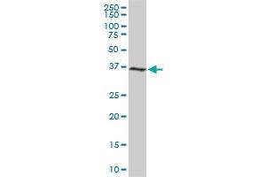 Western Blotting (WB) image for anti-Cyclin-Dependent Kinase 6 (CDK6) (AA 3-99) antibody (ABIN560298)