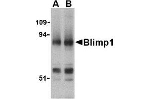 Image no. 1 for anti-PR Domain Containing 1, with ZNF Domain (PRDM1) (N-Term) antibody (ABIN200138) (PRDM1 anticorps  (N-Term))