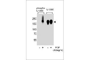 Western blot analysis of extracts from A431 cells,untreated or treated with EGF,100 ng/mL , using phospho-ERBB2-(left) or ERBB2 Antibody (right) (ErbB2/Her2 anticorps  (pTyr1139))