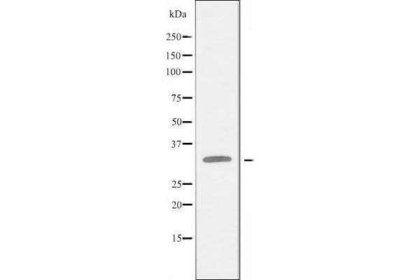 BCL2L12 anticorps  (Internal Region)