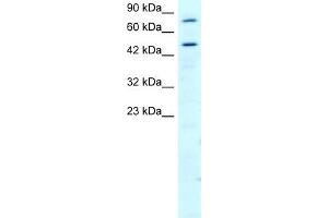 RGS9 antibody used at 2 ug/ml to detect target protein. (RGS anticorps  (N-Term))