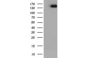 HEK293T cells were transfected with the pCMV6-ENTRY control (Left lane) or pCMV6-ENTRY L1CAM (Right lane) cDNA for 48 hrs and lysed. (L1CAM anticorps)