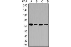 Western blot analysis of CD36 expression in MCF7 (A), A431 (B), mouse brain (C), mouse lung (D) whole cell lysates. (CD36 anticorps)