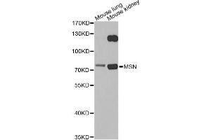 Western blot analysis of extracts of various cell lines, using MSN antibody. (Moesin anticorps)